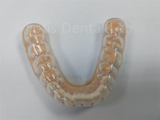Garde de nuit dure et douce professionnelle Gardez vos dents en bonne santé Protection des dents