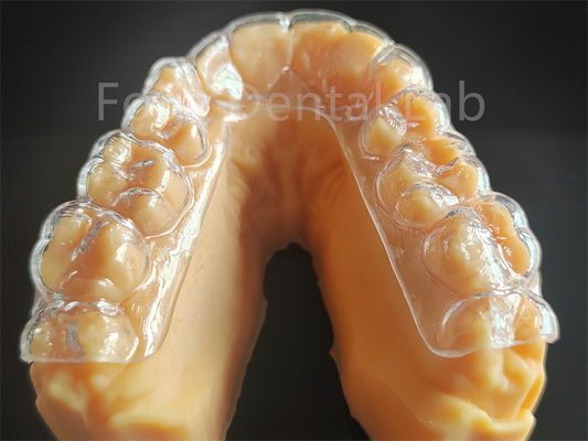 Garde-dentiste dur pour le grincement des dents
