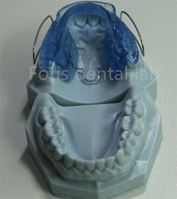 L'appareil de retenue orthodontique est réglable et personnalisable