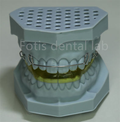 Laboratoire dentaire chinois Retenant de fil lingual pour l' expansion des dents