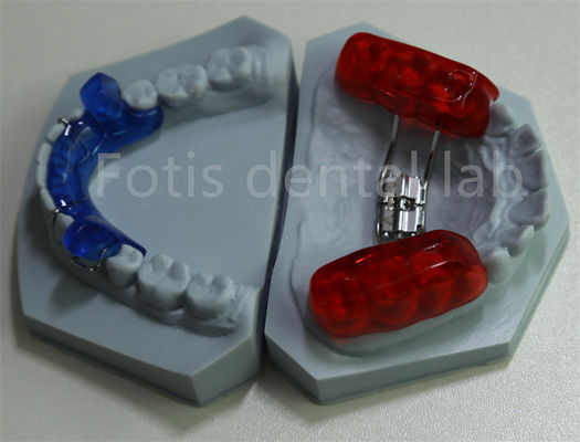 Retention efficace des dents Laboratoire dentaire ortodontique Gardien de l'espace pour l'expansion des dents