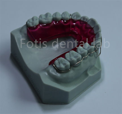 Retenant orthodontique expansateur Solution confortable et abordable