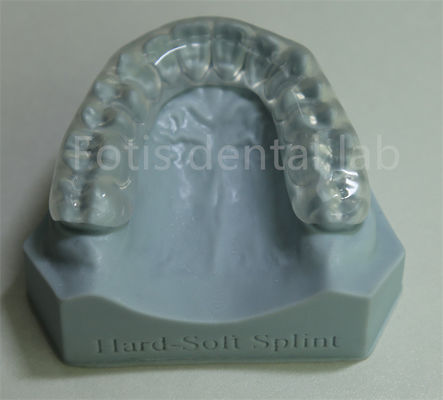 Retenant orthodontique réglable et personnalisable pour la rétention et l' expansion des dents