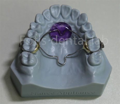 Laboratoire dentaire Affordable Orthodontic Expander Retenant efficace dans la rétention et l'expansion des dents