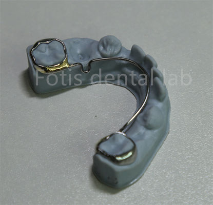 Retenant orthodontique pour l' expansion des dents
