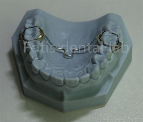 Rétenteur d'expansion dentaire polyvalent Solution abordable pour la plupart des traitements orthodontiques