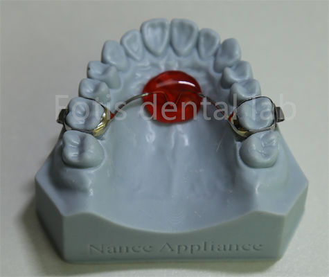 Laboratoire dentaire Élargisseur palatal orthodontique Abordable et compatible avec la plupart des traitements
