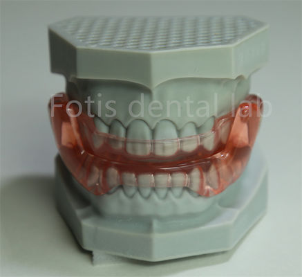 Retenant orthodontique OEM Expandant toutes tailles Compatible avec la plupart des traitements orthodontiques
