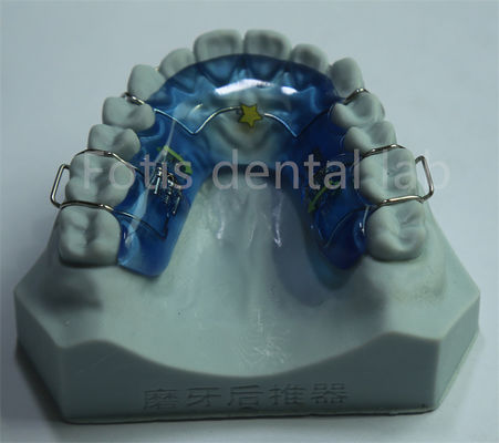 Élargisseur palatin orthodontique polyvalent facile à nettoyer et à entretenir pour des dents durables