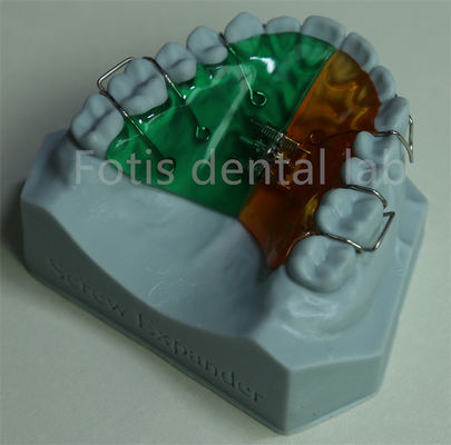 Extensor de retenue orthodontique polyvalent et confortable pour une rétention efficace des dents