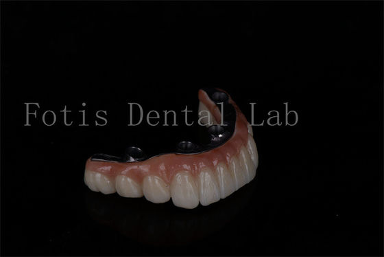 Bon prix Aucune limite d'âge abordable tout sur 6 implants de zirconium entretien facile en ligne